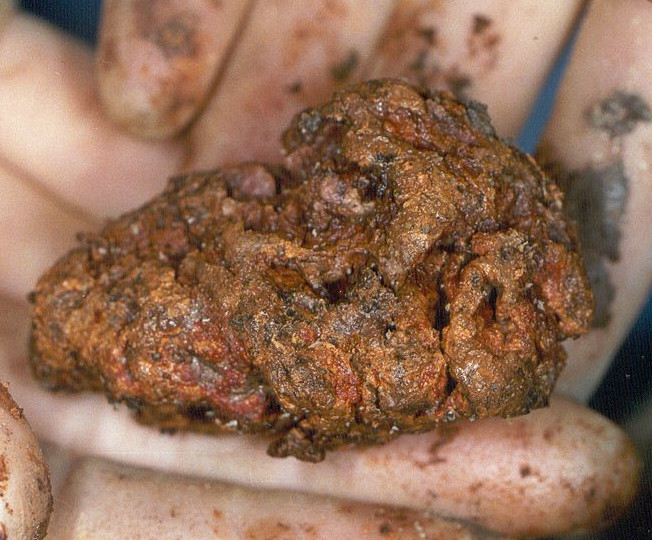 Egy kis darab emberi agyszövet, ami túlélt 2600 évet