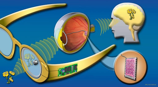 hogyan lehetne javítani a látást 75 évesen látomás 19-kor