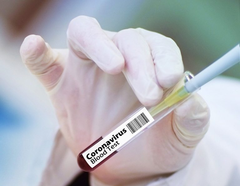 Kérdőjelek a milliós Remdesivir koronavírus-gyógyszer körül