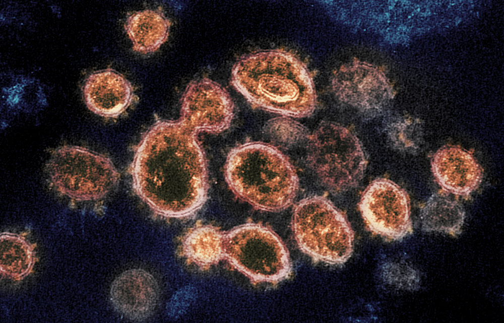 Magyar kutatók fejtették meg a koronavírus néhány fontos titkát