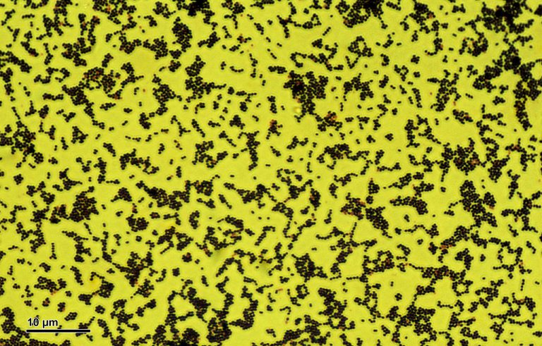Az immunrendszerünk számára láthatatlan, tökéletesen idegen baktériumokat találtak a Csendes-óceán mélyén