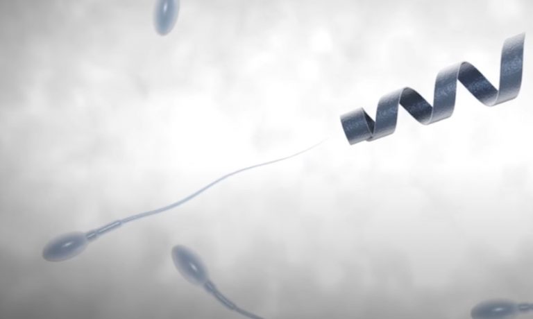 Mesterséges motoros meghajtást kaphatnának a lusta emberi spermiumok