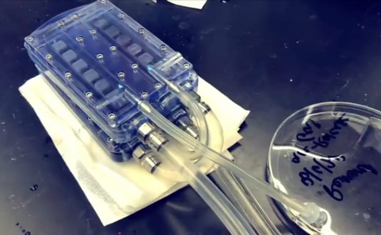 Emberi sejteket tartalmazó bioreaktorral működik az első mesterséges vese, amit sikerrel teszteltek