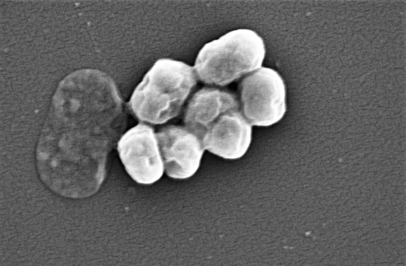 A Covid eltörpül ahhoz a pusztításhoz képest, amit az antibiotikumra rezisztens baktériumok okoznak majd