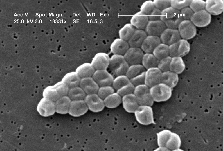 Ez az új antibiotikum könnyen felveszi a harcot a rezisztens baktériumokkal is